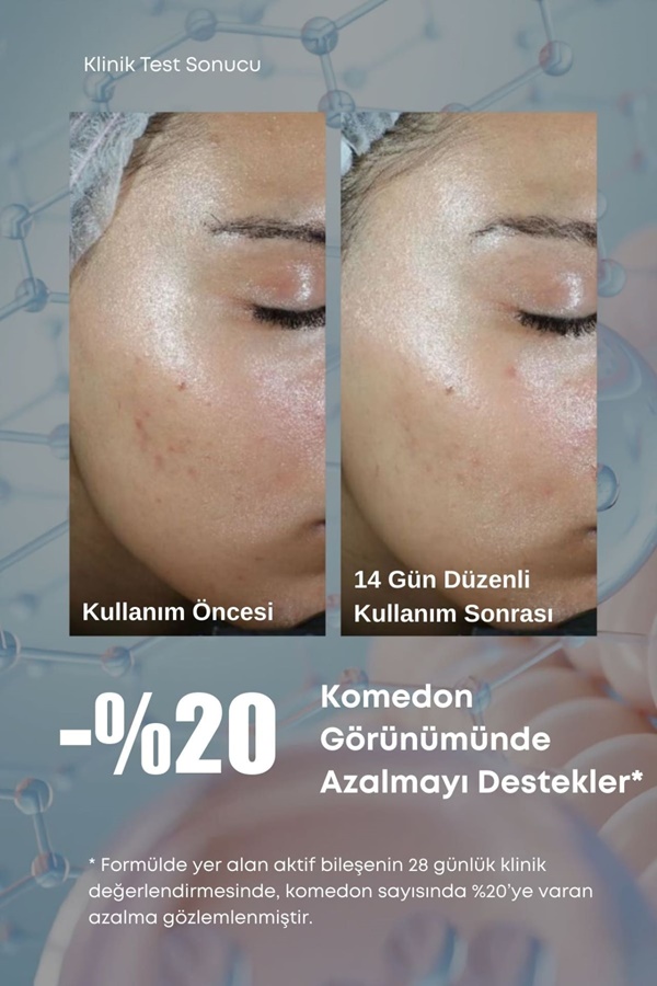 retinol, cilt bakımı, yaşlanma karşıtı, anti aging